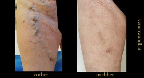 Dr. Ernst Wandl - Radiologe Wien 1070