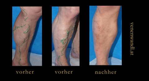 Dr. Ernst Wandl - Radiologe Wien 1070
