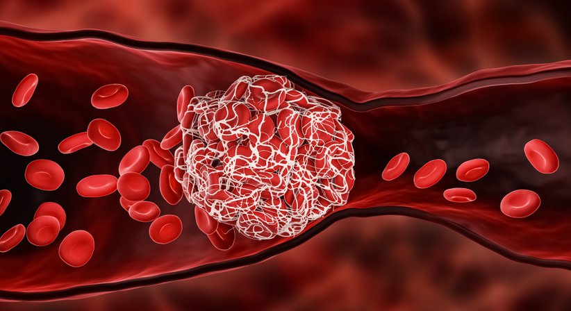 Abklärung von Blutungsstörungen - OÄ Dr. Ulrike Greilberger-Bischof - Frauenärztin Wien 1090