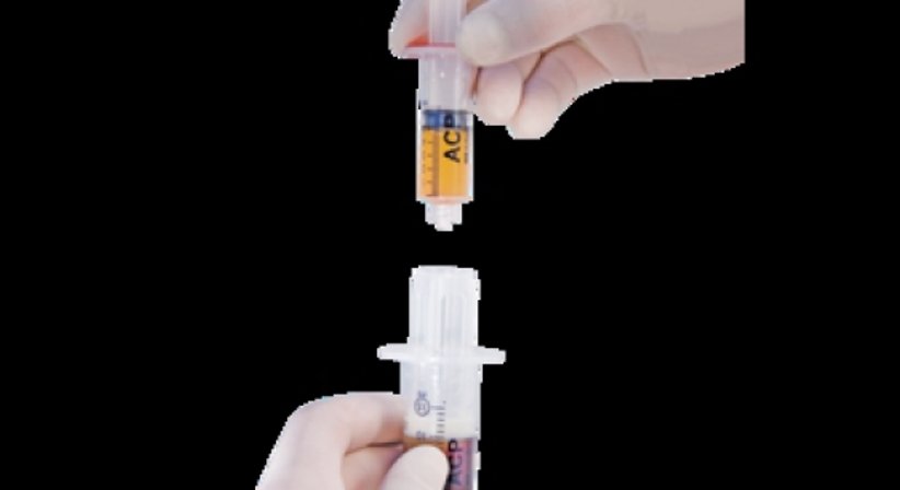 PRP - Platelet-rich-plasma - regenerative Medizin - Dr. Rudolf Johannes Stadlhuber - Allgemeinchirurg Salzburg 5020