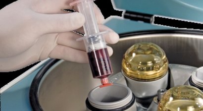 PRP - Platelet-rich-plasma - regenerative Medizin
