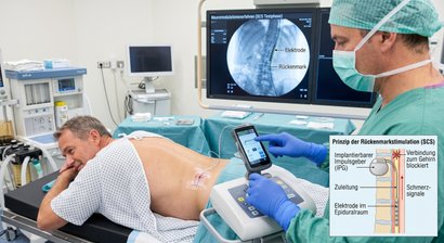 Neuromodulationsverfahren