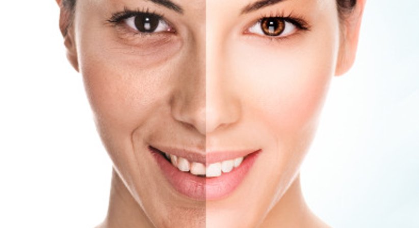 Lasertherapie - Dr. Michael Gasser - Hautarzt Villach 9500