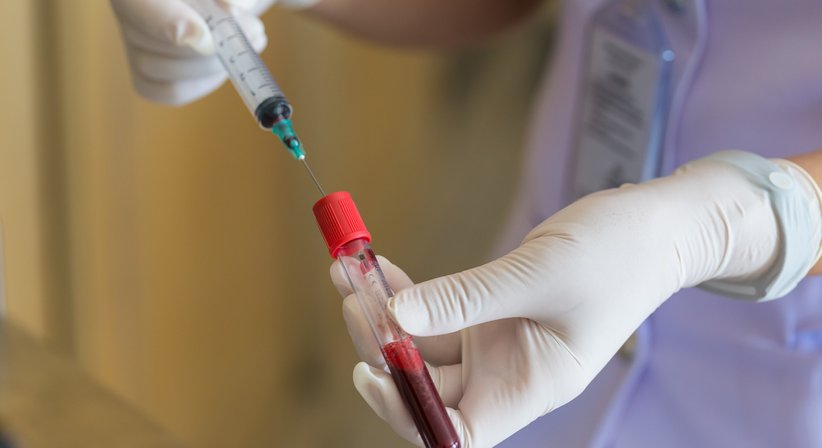 Eigenbluttherapie - Dr. Roman Wibmer-Neumayer - Orthopäde Baden 2500