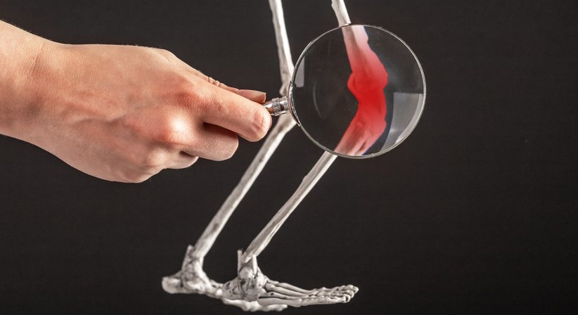 Kniegelenk - Dr. Roman Wibmer-Neumayer - Orthopäde Baden 2500