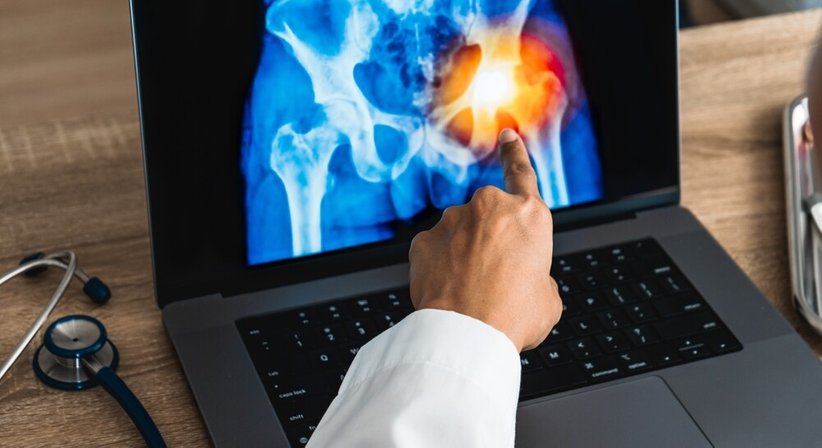 Hüftgelenk - Dr. Roman Wibmer-Neumayer - Orthopäde Baden 2500