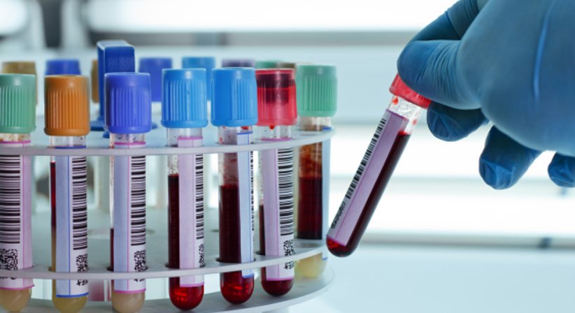 Blutschnelltest - Dr. Helene Gründorfer - Kinderärztin Wien 1190