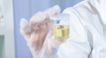 Komplette Harndiagnostik