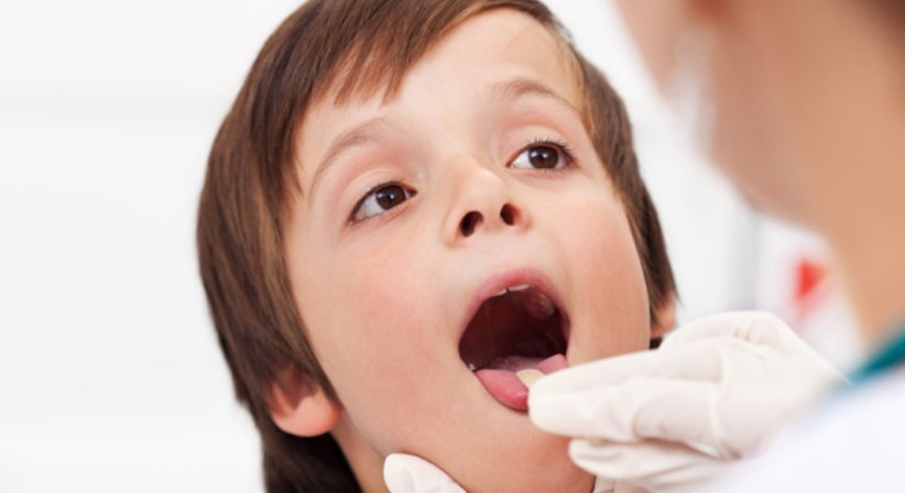 Rachenabstrich für STREP Test - Dr. Helene Gründorfer - Kinderärztin Wien 1190