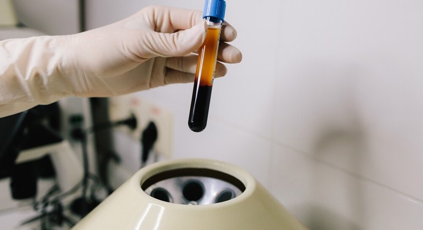 Eigenbluttherapie bei Knorpelschäden (PRP / ACP) bei Dr. Oliver Pieper