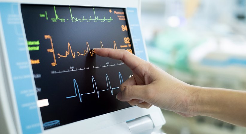 Elektrokardiogramm (EKG) - Dr. Konrad Rack - Internist Salzburg 5020