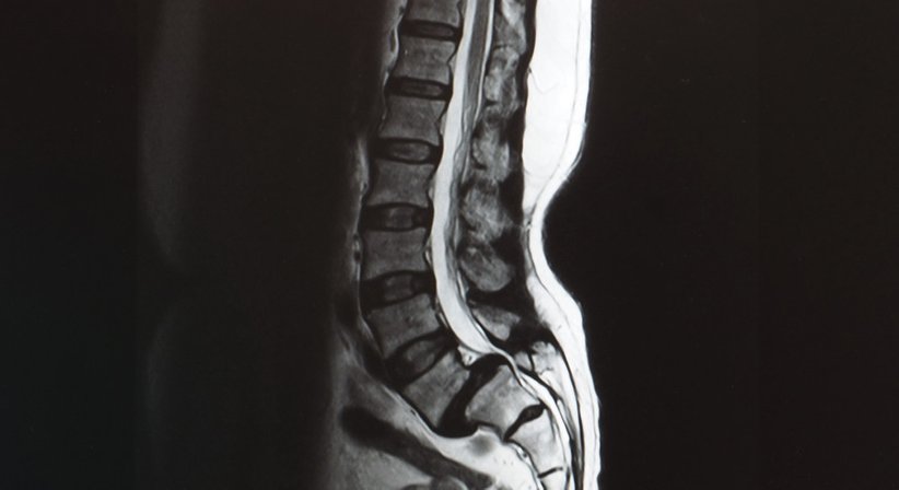 Sagittale Balance - a.o.Univ.Prof.Dr. Josef Georg Grohs - Orthopäde Wien 1190