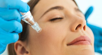 Medical Microneedling