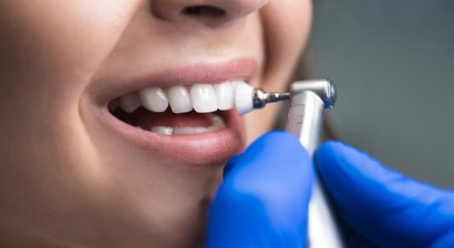 Professionelle Mundhygiene