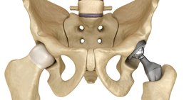 Dr. Michael Bösch - Orthopäde Wien 1020