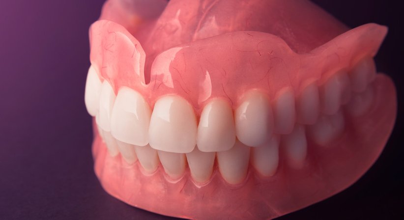 Prothese - DDr. Claudius Kwapinski - Zahnarzt Wien 1230