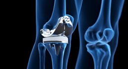 OA Dr. Rene Simon - Orthopäde Baden 2500