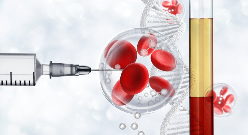Eigenblutbehandlung (ACP/PRP-Therapie) - OA Dr. Rene Simon - Orthopäde Baden 2500