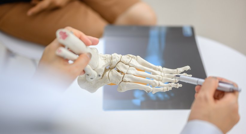 Fuß - OA Dr. Rene Simon - Orthopäde Baden 2500