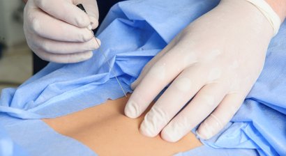 Infiltrationen (auch Röntgen- oder CT-gezielt)