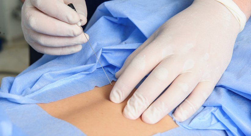 Infiltrationen (auch Röntgen- oder CT-gezielt) - OA Dr. Rene Simon - Orthopäde Baden 2500