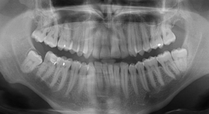 DVT - Digitale Volumentomographie - Dr. Thomas Mader - Radiologe Mödling 2340