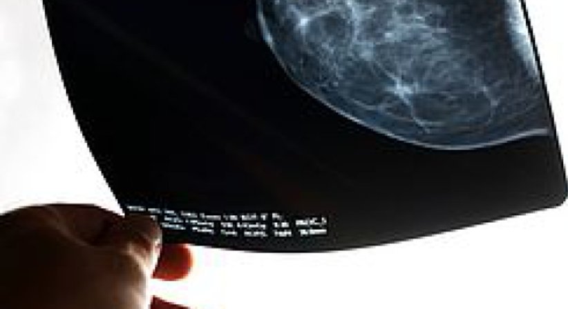 Mammographie - Dr. Thomas Mader - Radiologe Mödling 2340