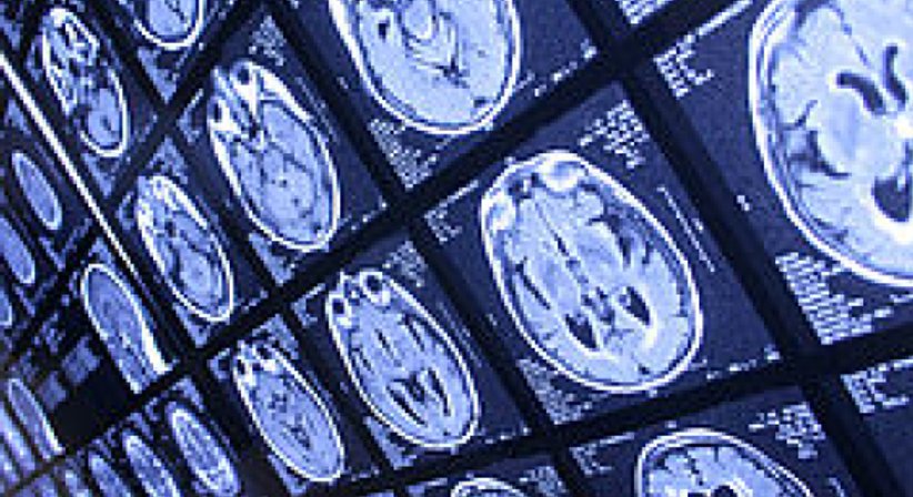 MR - Magnetresonanztomographie - Dr. Thomas Mader - Radiologe Mödling 2340