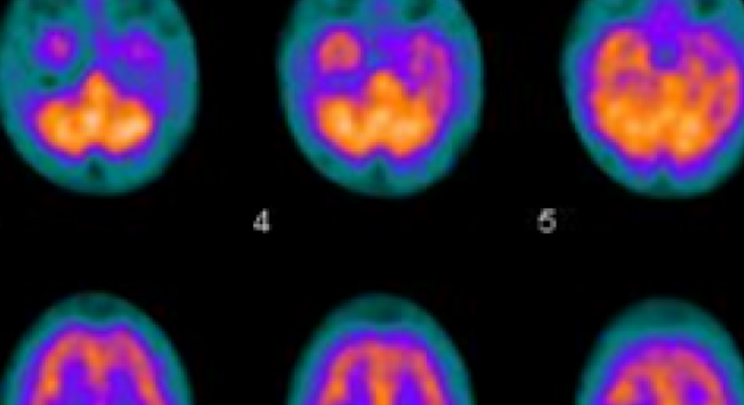 Nuklearmedizin - Dr. Thomas Mader - Radiologe Mödling 2340