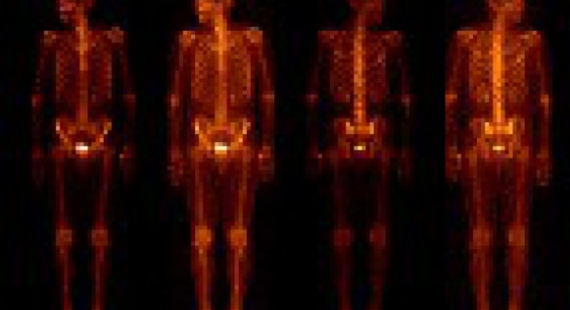 Nuklearmedizin - Dr. Thomas Mader - Radiologe Mödling 2340