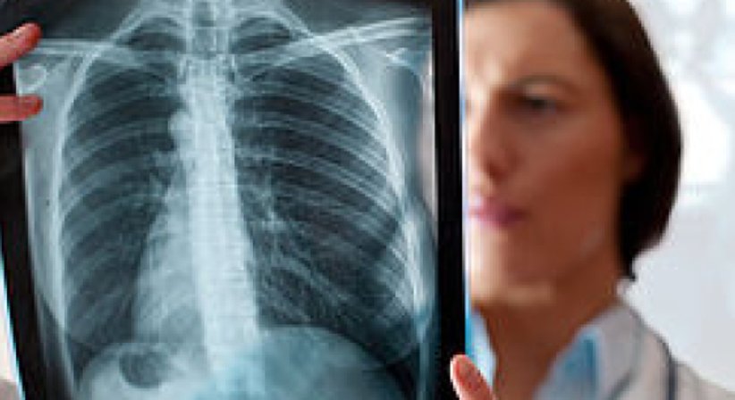 Röntgen - Dr. Thomas Mader - Radiologe Mödling 2340