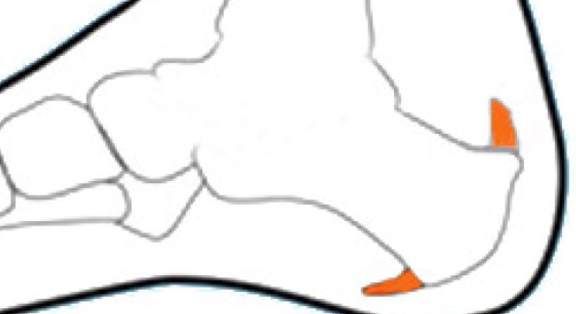 Röntgenschwachbestrahlung - Dr. Thomas Mader - Radiologe Mödling 2340