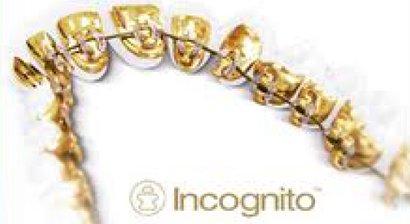 Incognito - Unsichtbare Zahnkorrektur