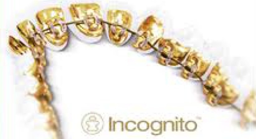 Incognito - Unsichtbare Zahnkorrektur - DDr. Andrea Borbely - Zahnärztin Wien 1050