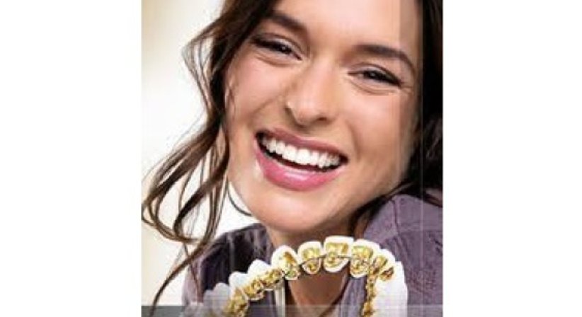 Incognito - Unsichtbare Zahnkorrektur - DDr. Andrea Borbely - Zahnärztin Wien 1050