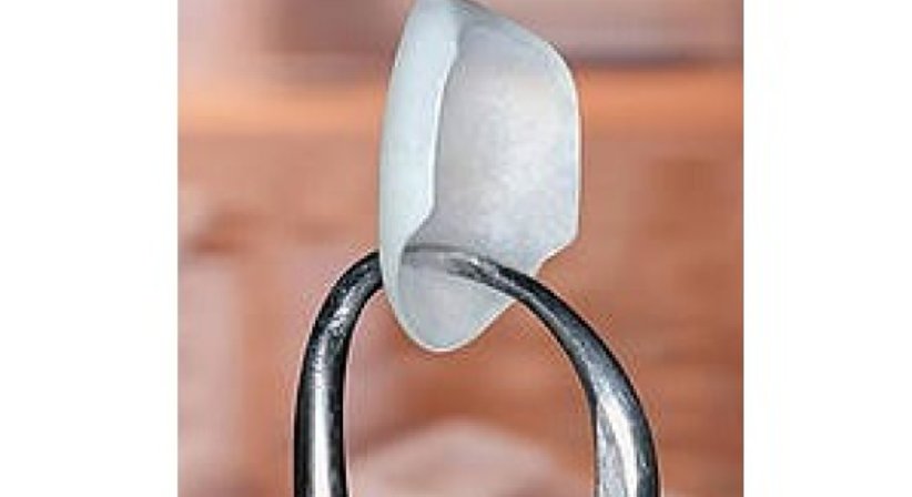 Veneers / Lumineers - DDr. Andrea Borbely - Zahnärztin Wien 1050