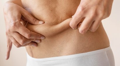 Bauchdeckenstraffung