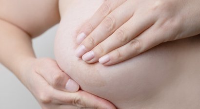 Brustvergrößerung mit Eigenfett