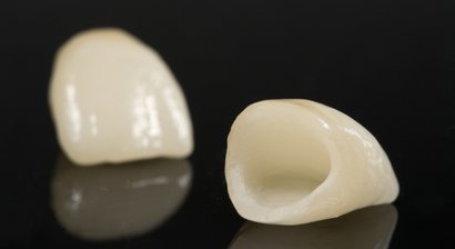 CAD/CAM (Vollkeramische Kronen, Brücken und Inlays)