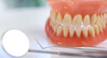 Wurzelspitzenresektion