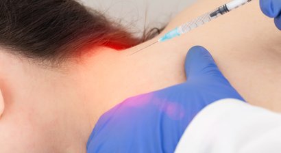 Injektion von Botulinumtoxin bei chronischer Migräne