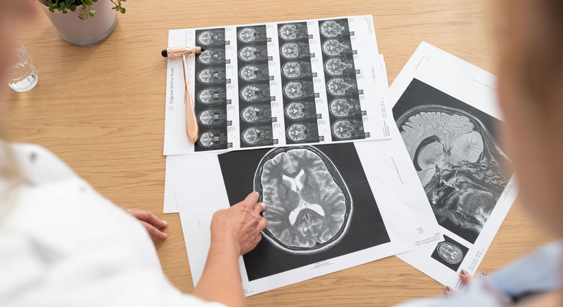 Schlaganfall - Vor- und Nachsorge - Dr. Kerstin Glössmann - Neurologin Baden 2500