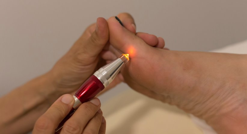 Laserakupunktur - Dr. Philipp Laber - Praktischer Arzt Salzburg 5020