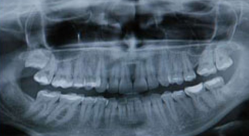 Zahnspange - DDr. Anna Piotrowski - Zahnärztin Wien 1030