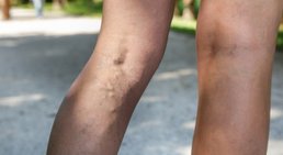 Univ.Prof. Dr. Erich Minar - Internist Wien 1090