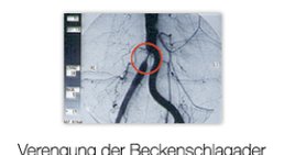 Univ.Prof. Dr. Erich Minar - Internist Wien 1090