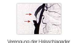 Univ.Prof. Dr. Erich Minar - Internist Wien 1090