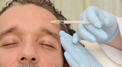Faltenbehandung: Botox, Hyaluronsäure, Radiesse