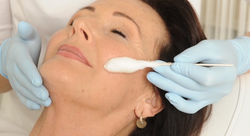 Peelings (Diamantpeeling, chemische Peelings) - Ao. Univ.Prof. Dr. Tamara Kopp - Hautärztin Wien 1010