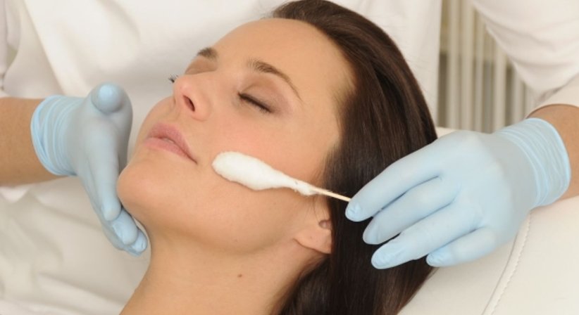 Peelings (Diamantpeeling, chemische Peelings) - Ao. Univ.Prof. Dr. Tamara Kopp - Hautärztin Wien 1010